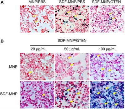 Magnetic Nano-Sized SDF-1 Particles Show Promise for Application in Stem Cell-Based Repair of Damaged Tissues